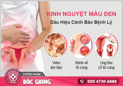 Kinh nguyệt màu đen - Cảnh báo bệnh phụ khoa âm thầm